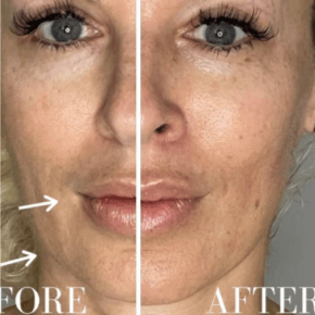 MICROCURRENT MAINTENANCE at Ritual Beauty in Syracuse, NY